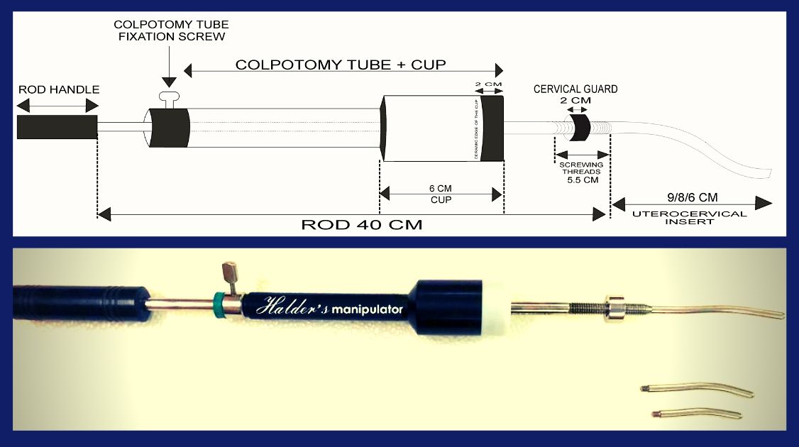 Halder's Uterine Manipulator